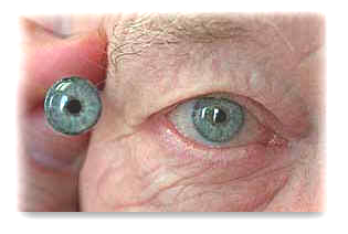 Artificial Eyes Cologne, Eye Prosthesis of Glass, Eye Prostheses